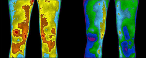 thermal images showing improvement of knee pain before and after grounding