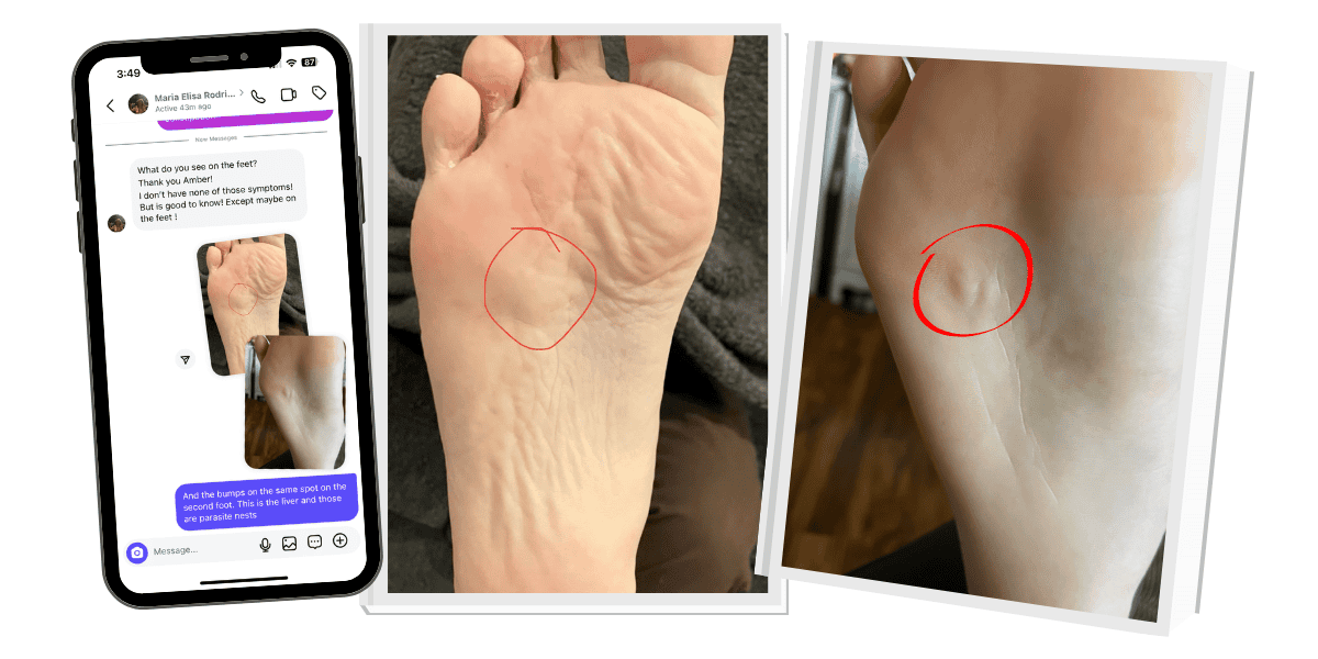 feet showing signs of parasites